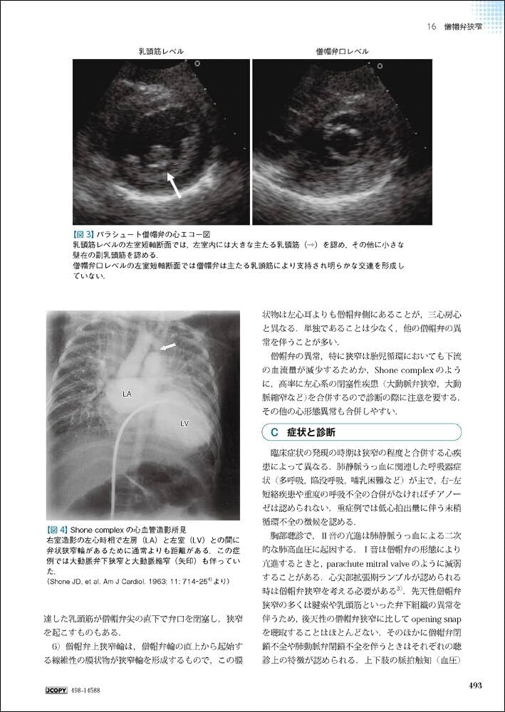 新 発達心臓病学 | 中西 敏雄, 先崎 秀明, 山岸 敬幸 |本 | 通販 | Amazon
