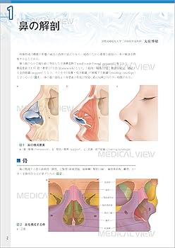 外鼻形成術−機能と形態を両立した手術 | ライノプラスティー研究会