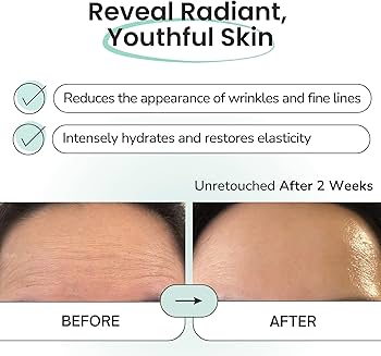 Amazon.com : Advanced Forehead Wrinkle Patches Overnight - Anti