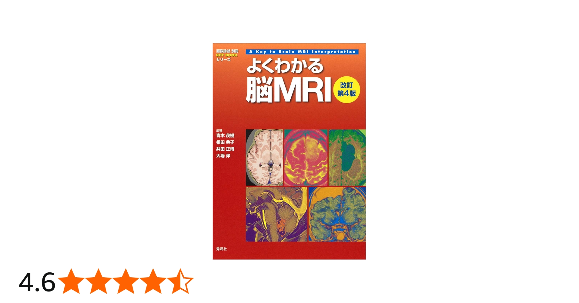 よくわかる脳MRI 改訂第4版 (画像診断別冊KEY BOOKシリーズ) | 青木