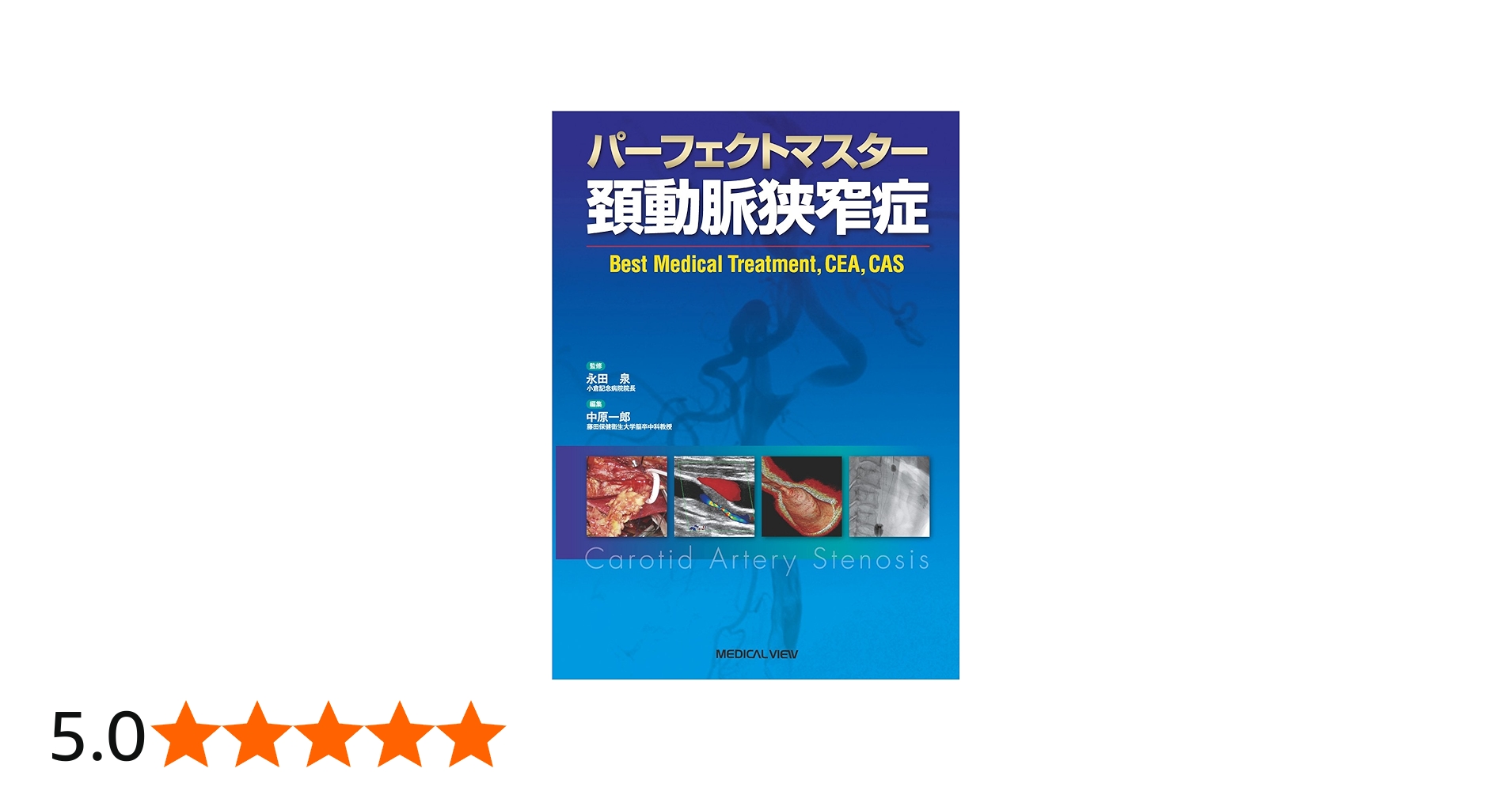 パーフェクトマスター 頚動脈狭窄症 | 永田 泉, 中原 一郎 |本 | 通販