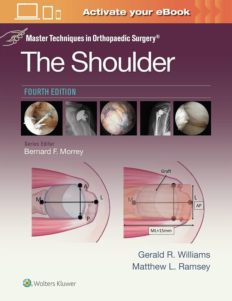Master Techniques in Orthopaedic Surgery: The Shoulder: Print +