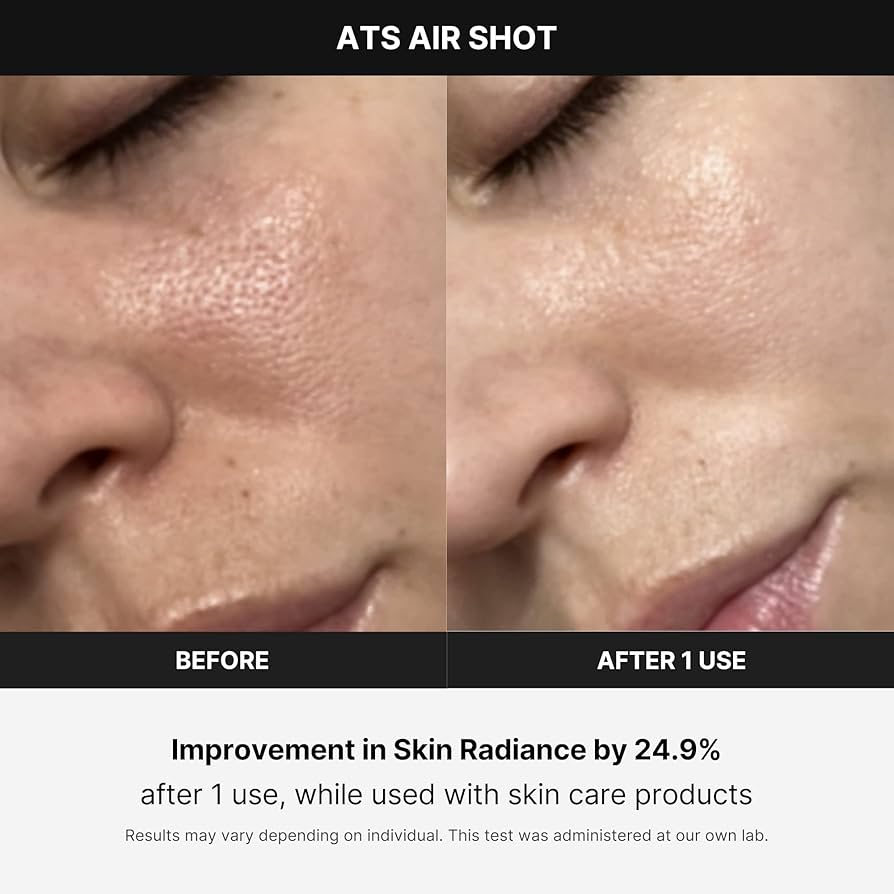 Amazon.com: Medicube Age-R ATS Air Shot - Microneedling Pore