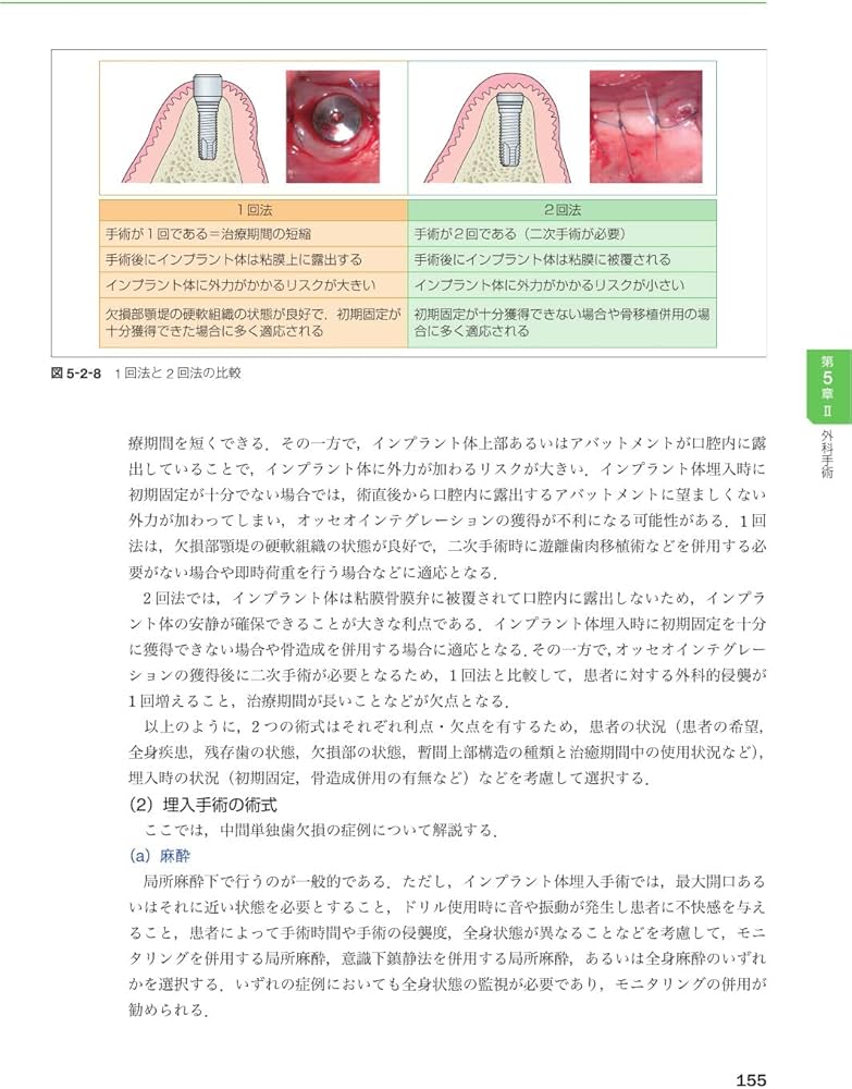 よくわかる口腔インプラント学 第4版 | 赤川 安正, 細川 隆司, 横山