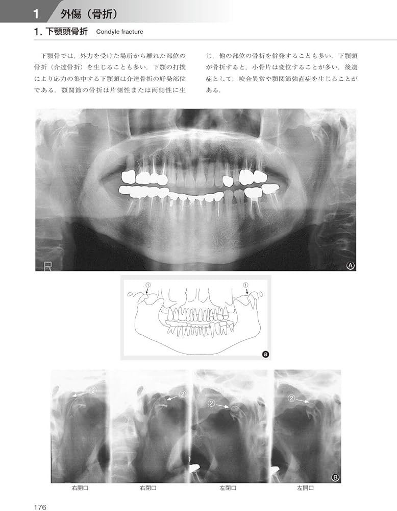 歯科臨床における画像診断アトラス 第2版 | 日本歯科放射線学会 |本