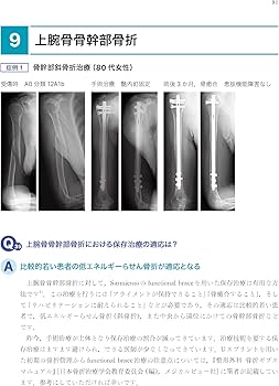 Amazon.co.jp: 「考える」外傷整形外科! : 土田 芳彦: 本