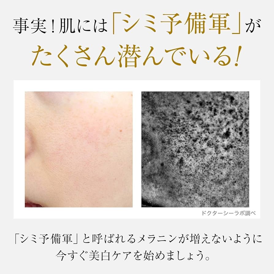 Amazon | (旧モデル) 薬 用 アクア コラーゲン ゲル 美白 EX 200g