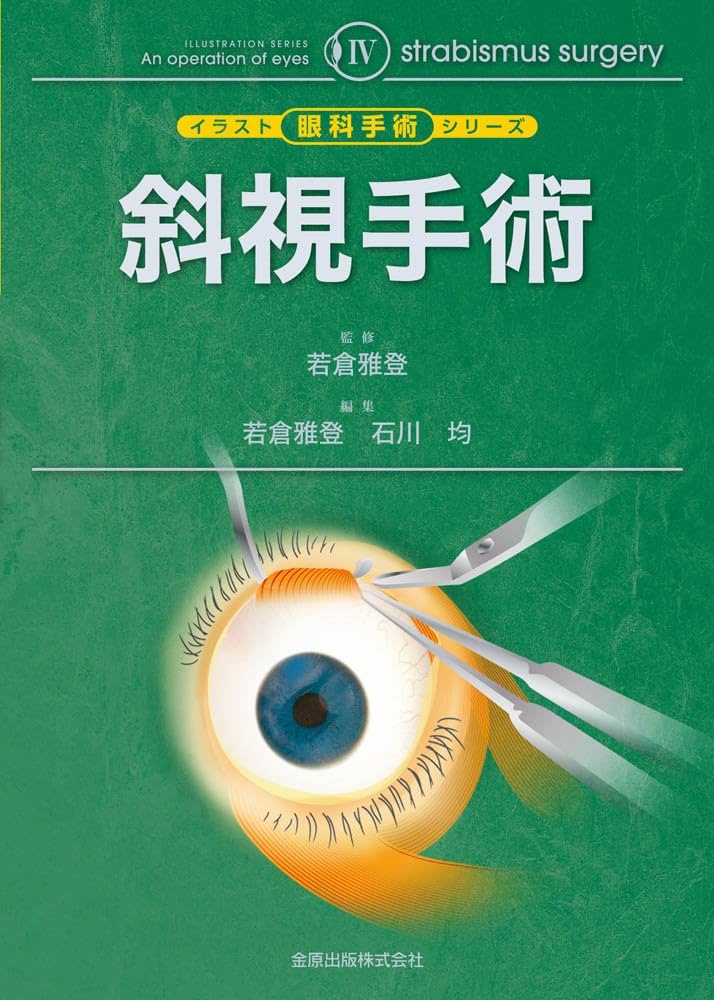 Amazon.com: イラスト眼科手術シリーズIV 斜視手術: 9784307351560