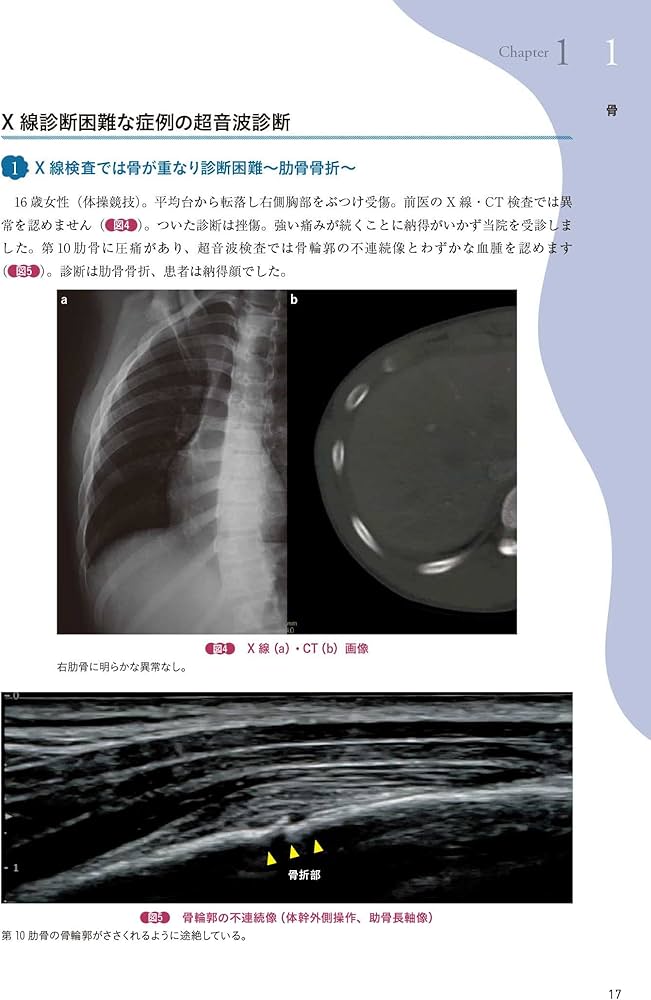 運動器エコーのメタ診療: 実臨床に役立つAR動画100本付き | 皆川 洋至