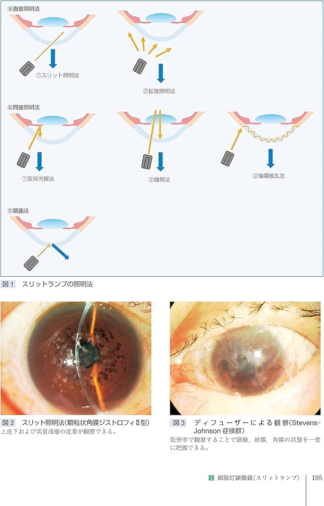 Amazon.co.jp: 角膜クリニック 第3版 : 眞鍋 禮三, 木下 茂, 大橋 裕一