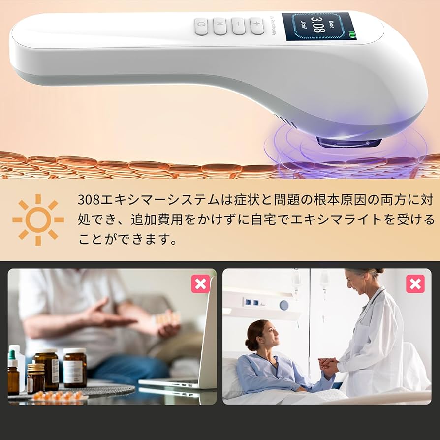 Amazon | エキシマライト光線 308エキシマーシステム 家庭用エキシマー