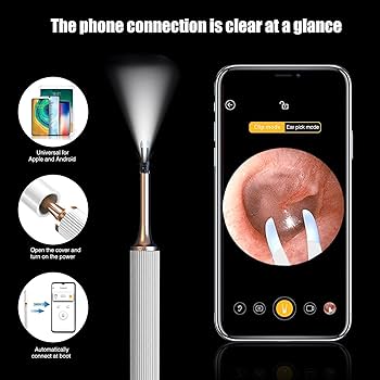 Amazon.co.jp: BEBIRD Note3 Pro Max 耳かき カメラ メカニカルアーム