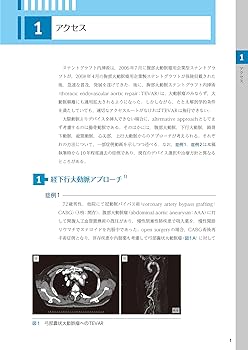 71NYLZLUCcL._AC_UF350,