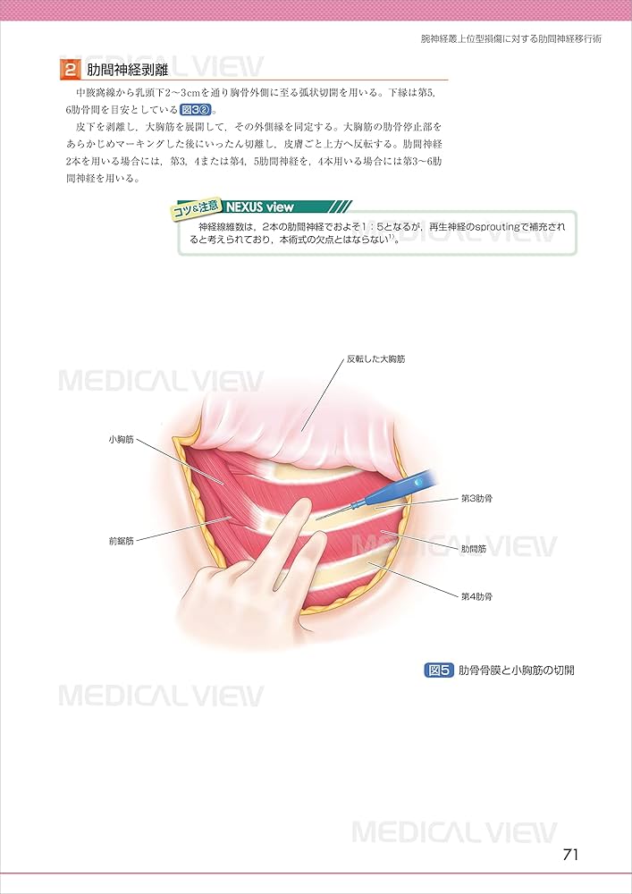 末梢神経障害・損傷の修復と再建術 (OS NEXUS(電子版付き) 17) | 岩崎
