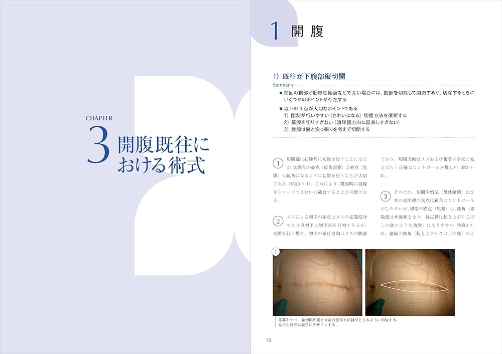 エキスパートこだわりの帝王切開術：理論＋根拠を押さえてコツを得る