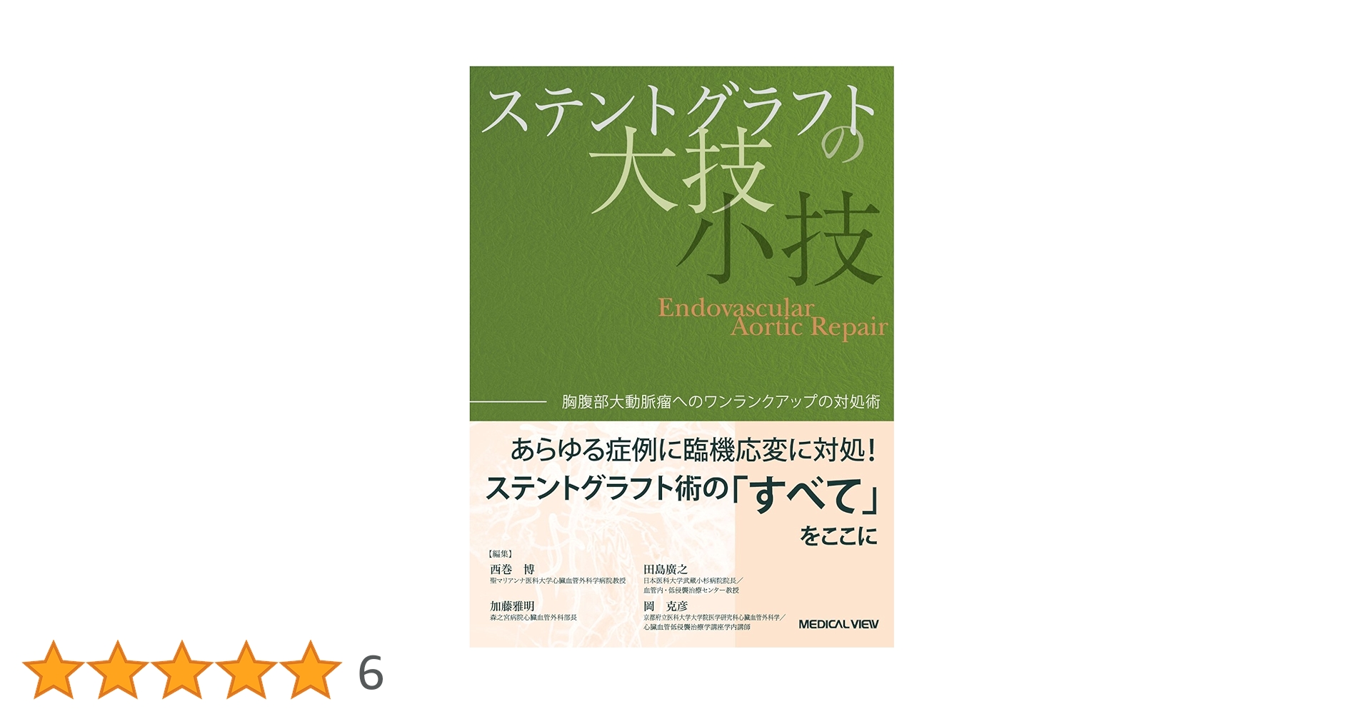 Amazon.co.jp: ステントグラフトの大技・小技−胸腹部大動脈瘤への