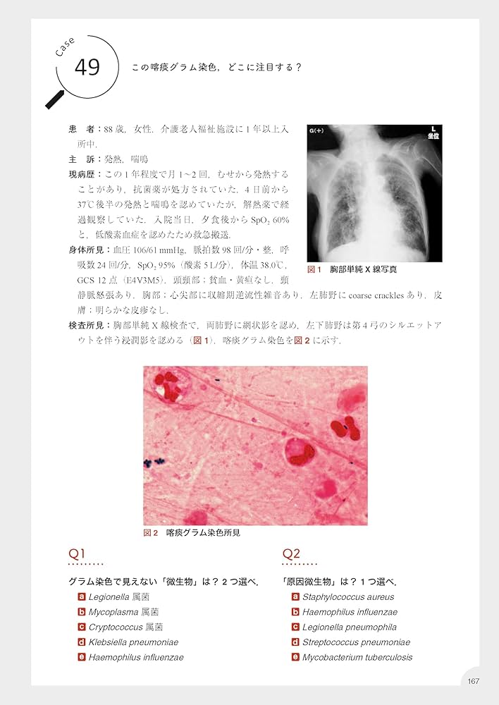 感染症内科ドリル WEB版付: みるトレ決定版 | 笠原 敬, 忽那 賢志