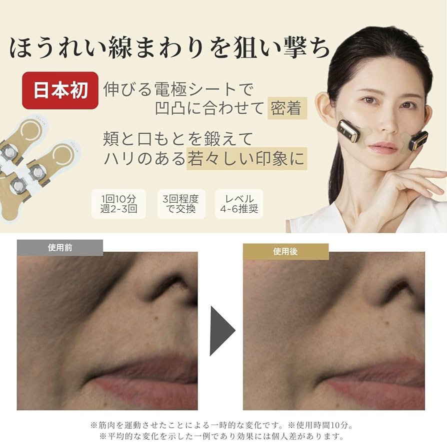 Amazon.co.jp: 【Amazon.co.jp限定】ヤーマン 美顔器 デザインリフト