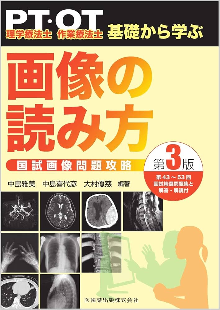 理学療法士・作業療法士 PT・OT基礎から学ぶ 画像の読み方 第3版 国試