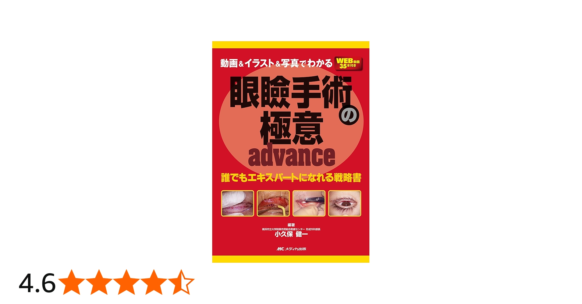 動画＆イラスト＆写真でわかる眼瞼手術の極意 advance：誰でも