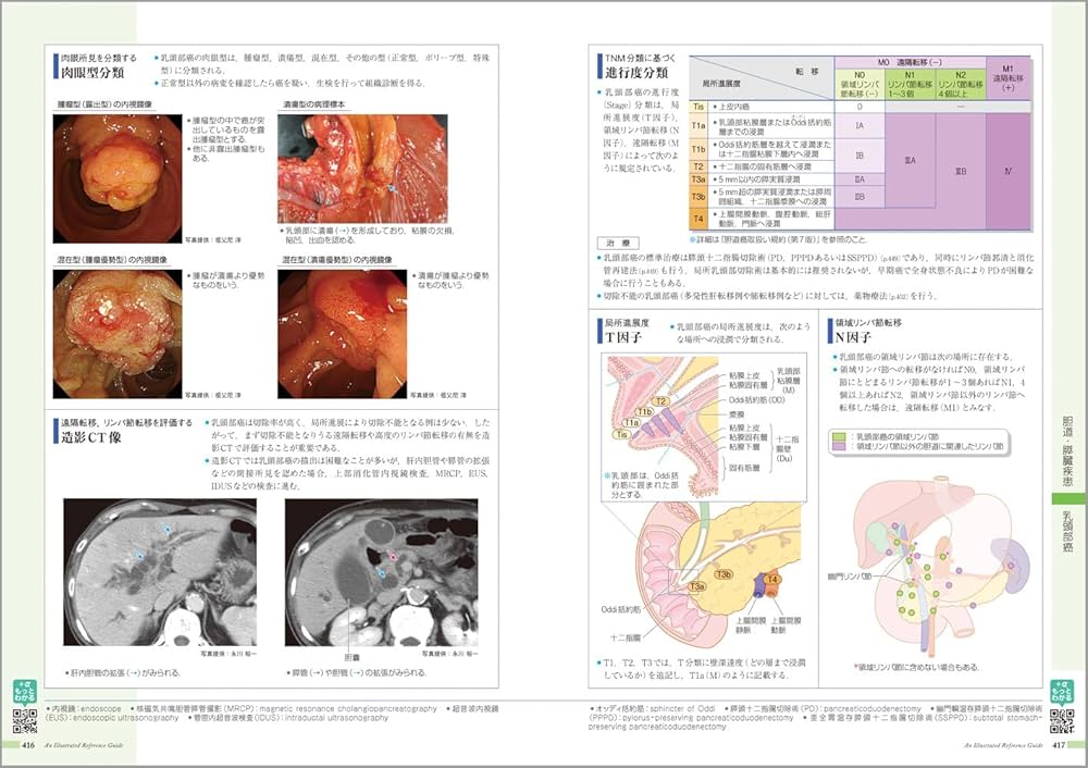 病気がみえるvol.1 消化器 第7版 | 医療情報科学研究所 |本 | 通販