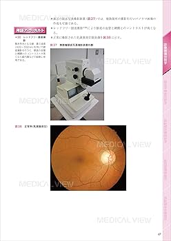 診療放射線技師 イエロー・ノート 臨床編 | 福士 政広 |本 | 通販 | Amazon