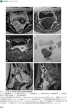 産婦人科の画像診断 第2版 | 田中 優美子 |本 | 通販 | Amazon
