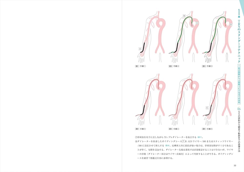 71f0aX7zXdL._AC_UF1000,