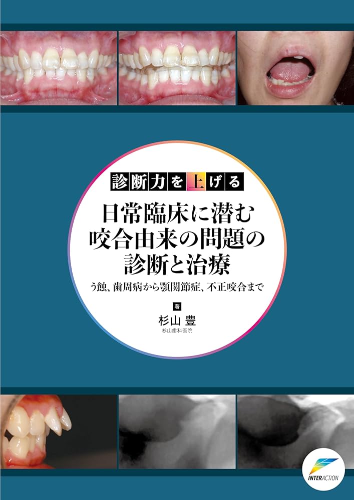 診断力を上げる 日常臨床に潜む咬合由来の問題の診断と治療: う蝕、歯