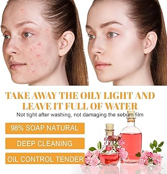 Amazon.com: YG LianKai Turmeric Facial Cleanser,Foaming Face Wash