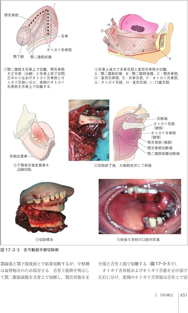 口腔外科学 第4版 | 白砂 兼光, 古郷 幹彦 |本 | 通販 | Amazon