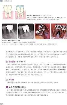 臨床歯周病学 第3版 | 村上 伸也, 申 基喆, 齋藤 淳, 山田 聡 |本