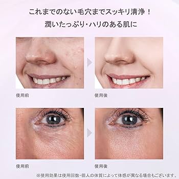 Amazon.co.jp: 美顔器 COSBEAUTY アクリアルピーリングプロEX-HIGH