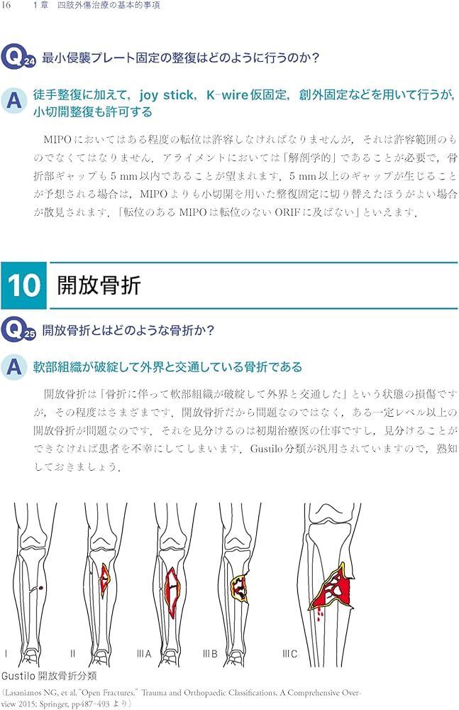 Amazon.co.jp: 「考える」外傷整形外科! : 土田 芳彦: 本