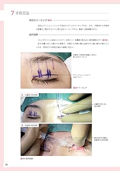 顔の美容外科手術 | 飯田秀夫 |本 | 通販 | Amazon