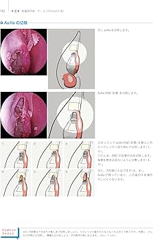 Amazon.co.jp: ウォーモルド直伝 内視鏡下鼻副鼻腔手術トレーニング