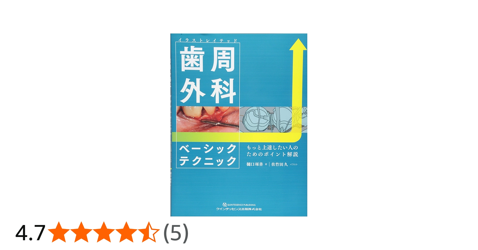 イラストレイテッド 歯周外科ベーシックテクニック | 樋口 琢善, 佐