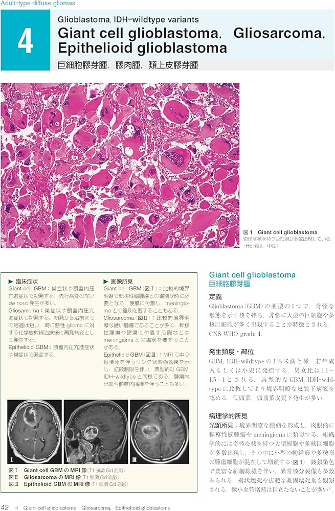 Amazon.co.jp: 脳腫瘍臨床病理カラーアトラス 第5版 : 日本脳腫瘍病理