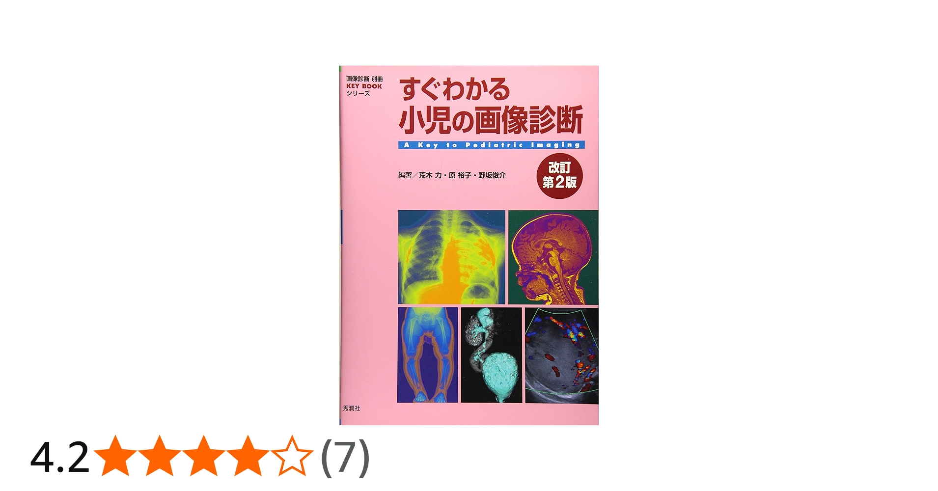 すぐわかる小児の画像診断 改訂第2版 (画像診断別冊KEYBOOKシリーズ
