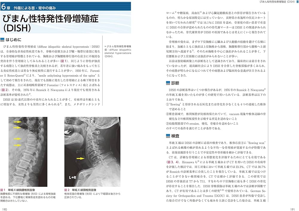頚椎・胸椎の痛みと障害 (ニュースタンダード整形外科の臨床) | 筑田