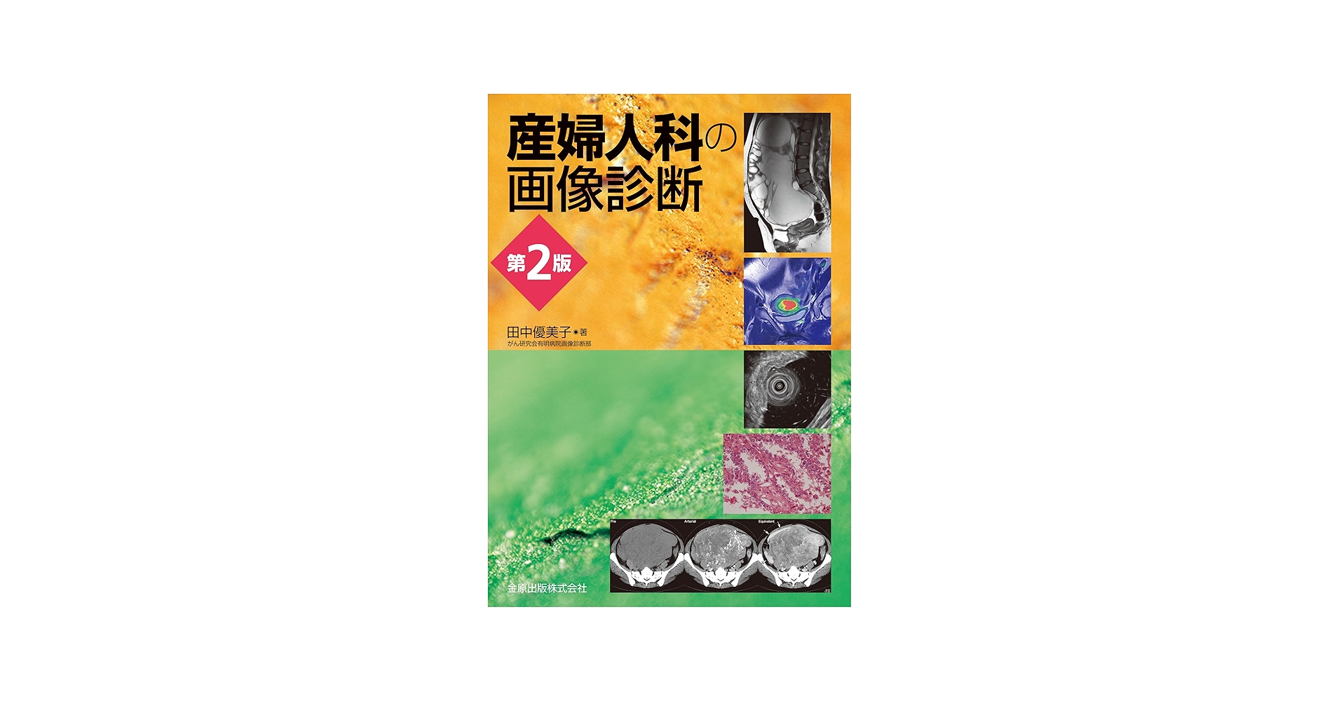 産婦人科の画像診断 第2版 | 田中 優美子 |本 | 通販 | Amazon