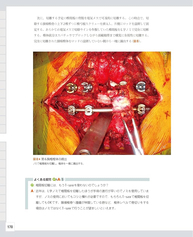 整形外科医のための脊椎のアドバンスト手術 | 石井 賢 |本 | 通販 | Amazon