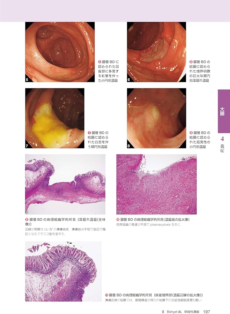 胃と腸アトラスII 下部消化管 第3版 | 「胃と腸」編集委員会, 松本 主