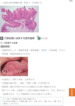 病理学・口腔病理学 (歯科国試パーフェクトマスター) | 槻木 恵一