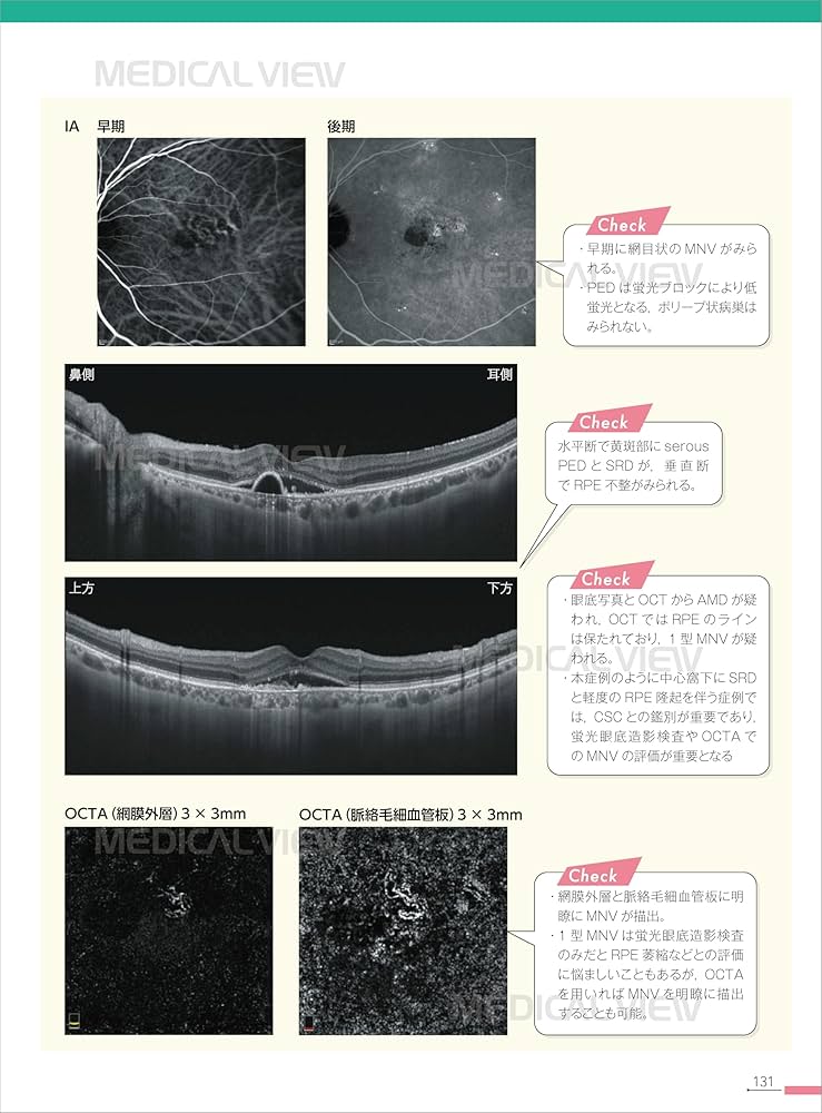 新OCT・OCTA読影トレーニング−改訂第2版 | 飯田 知弘, 森實 祐基