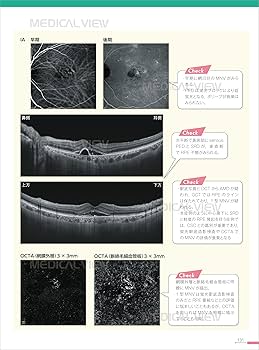 新OCT・OCTA読影トレーニング−改訂第2版 | 飯田 知弘, 森實 祐基