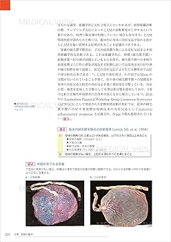 基礎と臨床の両側面からみた 胎盤学 | 日本胎盤学会 |本 | 通販 | Amazon