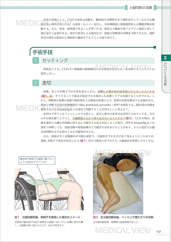 四肢切断術のすべて［Web動画付］ | 田中 康仁, 富村 奈津子 |本