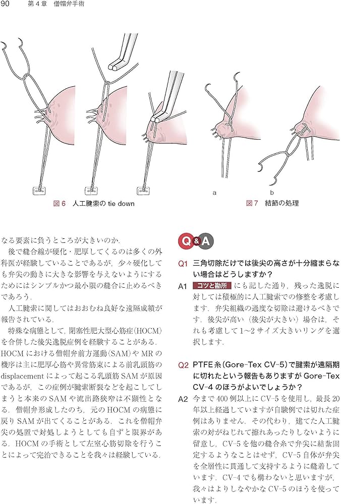 心臓・大動脈外科手術: 基本・コツ・勘所 | 小坂 眞一 |本 | 通販 | Amazon