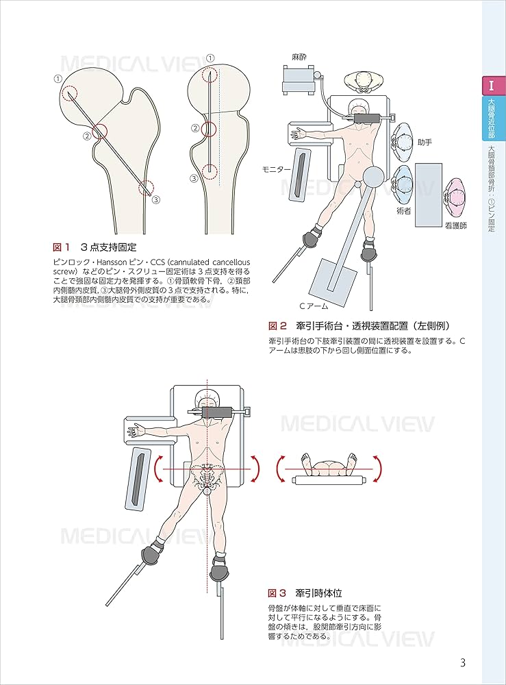 スタンダード骨折手術治療 下肢 | 渡部 欣忍 |本 | 通販 | Amazon